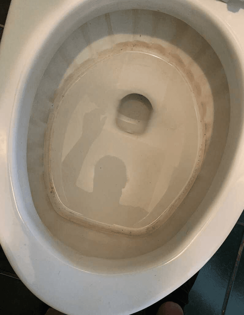 Stained toilet bowl before cleaning